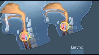 GlideScope Pediatric Airway Rounds Small Anatomies [upl. by Hanselka546]