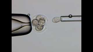 OCTAX LaserShot PGD blastomere byopsy procedure [upl. by Sosthenna]