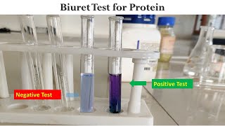 Biuret Test [upl. by Eelyac]