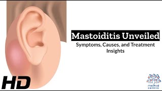 Mastoiditis The Hidden Danger Behind Ear Infections [upl. by Lukash]