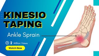 How to treat an Ankle Inversion Sprain  Kinesiology Taping to stabilise ligaments [upl. by Annonyw]