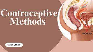 Contraceptive methods  Gynaecology Lecture  Part 11 [upl. by Ynnavoig]