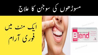 Masoro ki Sujan ka ilaj  Gum Swelling Treatment in Urdu amp Hindi [upl. by Notlok]