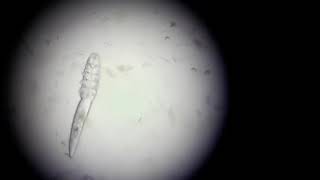 Demodex canis under the microscope  Veterinary Video [upl. by Goodyear]