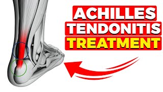 Back of the Heel Achilles amp Bone Spur Pain Simple Home Treatment [upl. by Ambrose]