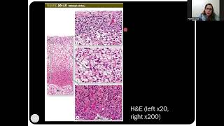 Histology of the Adrenal Suprarenal Glands [upl. by Piefer108]