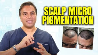 What is Scalp Micro pigmentation  The Hair Loss Show [upl. by Bevin161]