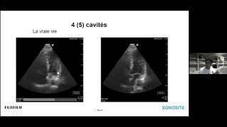 Webinaire Echographie thoracique en Anesthésie [upl. by Sisi]