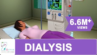 Procedure of DIALYSIS [upl. by Nazay398]