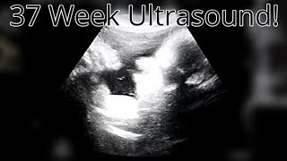 37 Week Ultrasound  How Big Is Baby [upl. by Hapte408]