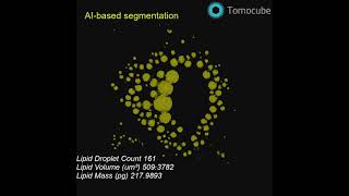 Quantification of Lipid Droplet Maturation in Differentiated Adipocyte Cells [upl. by Nnanaej]