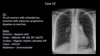 How to Interpret a Chest XRay Lesson 10  Self Assessment Part 2 [upl. by Naquin]