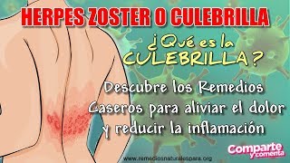 🔥 HERPES EN LA PIEL 🔥 Como curar la CULEBRILLA  HERPES ZOSTER  Rápido con Remedios Caseros💚 [upl. by Yasdnil185]