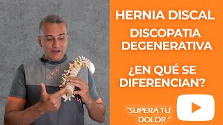 ¿En qué se diferencian la Hernia Discal y la Discopatía degenerativa Te lo contamos en este vídeo [upl. by Rysler]