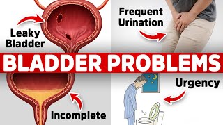 The 1 Vitamin Deficiency behind Bladder Issues Freq Urination Leaky Urgency [upl. by Alva496]