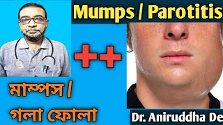 Mumps  Parotitis  মাম্পস  গলা ফোলা  Homeopathy Dr Advice in Bengali  DrAniruddhaDe [upl. by Leohcin]