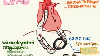 LVAD 01 Anatomy and Physiology [upl. by Dev291]