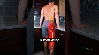 Decompression for Sciatica Relief [upl. by Ruckman665]