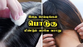 பொடுகு முற்றிலும் நீங்கி இனி வரவே வராது  AntiDandruff Treatment Remedies amp Tips at Home [upl. by Gilud450]