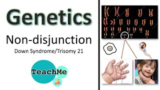 33  Trisomy 21 Down syndrome  NonDisjunction   IB Biology  TeachMe [upl. by Rhiamon]