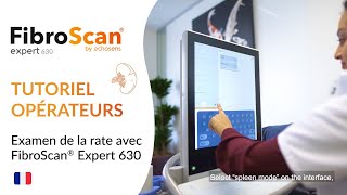 FibroScan® Expert 630  Tutoriel mesure de lélasticité de la rate [upl. by Yellat]