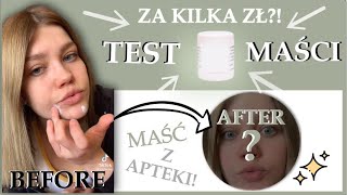 Test pasty cynkowej za 4 zł z apteki przed i po [upl. by Ahteres]