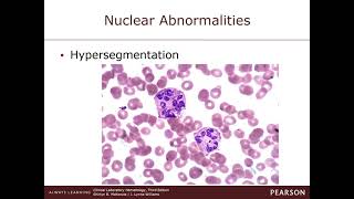 Chapter 21 Nonmalignant disorders of Granulocytes and Monocytes [upl. by Blaine]