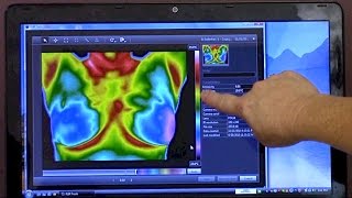 WHAT IS THERMOGRAPHY INTERVIEW WITH BOSTON THERMOGRAPHY CENTER  Cancer Education amp Research Inst [upl. by Ashli]