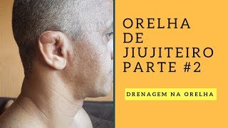 Orelha de Jiujiteiro Parte 2 [upl. by Heater]