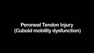 Peroneal Tendon Injury Cuboid mobility dysfunction [upl. by Munafo]