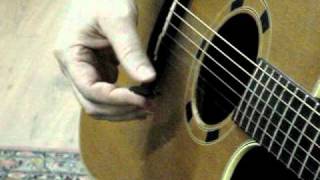 6Guitarist and hand dystonia difficulty holding the plectrum [upl. by Assirrak]