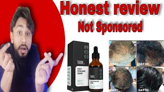 THRIVEco hair serum 20  Honest Review  Use  benefits  side effects [upl. by Akienaj]