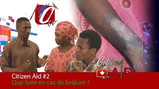 Que faire en cas de brulure  Citizen Aid 2  Obelus Tv [upl. by Nahtonoj]