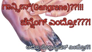 ಗಾನ್ಗ್ರೀನ್Gangrene ಚೆನ್ನೆಂಗ್ ಎಂದ್ರೋಅದ್ರೊ ಸೊಲ್ಯೂಷನ್ ಎಂದ್ರೋ  Doctor tips in beary [upl. by Kcir641]