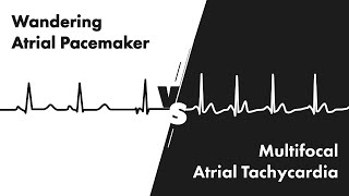 Wandering Atrial Pacemaker vs Multifocal Atrial Tachycardia  ECG EKG Interpretation  MEDZCOOL [upl. by Odlonyer]