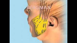 Slift animation Cosmetic Surgery in Bergman Clinics [upl. by Bills943]