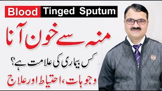 Blood Tinged Sputum  Moun se khoon ana  Khoon Thukna  Causes By Dr Tariq Ali Sheikh [upl. by Leverett51]