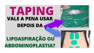 Prevenção de Fibroses Inchaço Umbigo triste Vale a pena usar o tape [upl. by Yance]