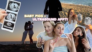 taking pregnancygender reveal pics first ultrasound  qampa [upl. by Issiah]