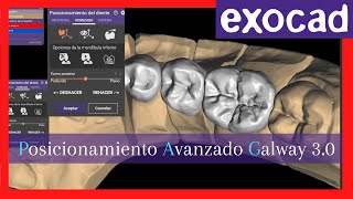 Posicionamiento de anatomias avanzado en exocad Galway 30💥 [upl. by Nojram994]