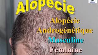 Chute de Cheveux  Alopécie androgenique chez lHomme et chez la Femme [upl. by Akinor]