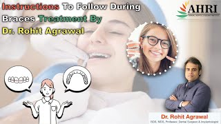 Instructions To Follow During Braces Treatment By Dr Rohit Agrawal [upl. by Isaac]