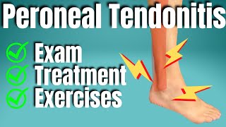 Peroneal Tendonitis Treatment  San Diego Sports Chiropractic [upl. by Salaidh]