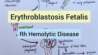 Hemolytic Disease of Fetus amp Newborn [upl. by Euqinitram117]