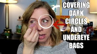 COVERING DARK CIRCLES AND UNDEREYE BAGS [upl. by Yrffej888]