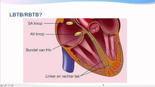 Introductiecursus ECG interpretatie [upl. by Wallach]