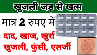 cetirizine tablet  cetirizine tablet uses in hindi  खुजली की गोली [upl. by Chilt308]