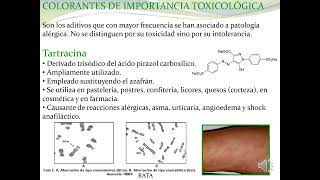 22 2 Toxicología de los alimentos [upl. by Worthy214]