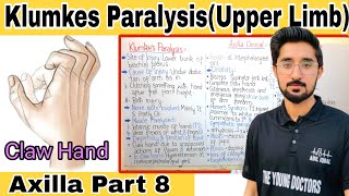 Klumkes Paralysis Brachial Plexus Clinical Klumpke Paralysis Brachial Plexus Clinical Anatomy [upl. by Tirma]