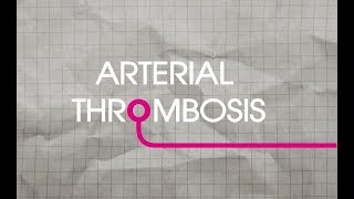 Arterial Thrombosis Explained [upl. by Gold111]